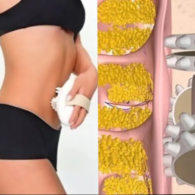 Масажер антицелюлітний Shuqin Body Slimmer SQ 100, Білий