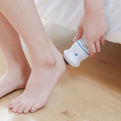Електрична пемза-пилка для ніг Pedi Vac Прилад для видалення мозолів з вакуумним пилососом акумулятор USB, Білий